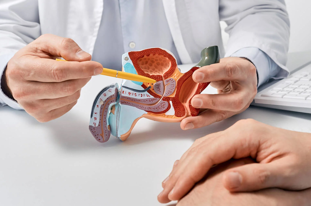 Male Infertility